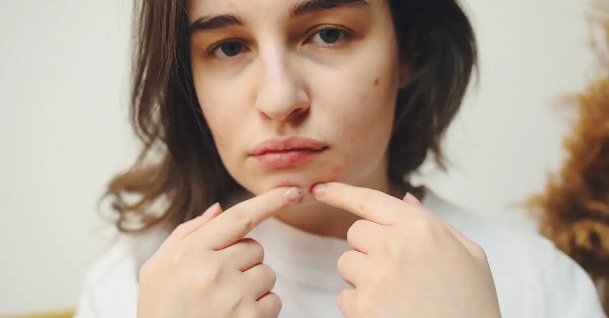 Hormonale acne voeding: wat helpt en wat niet