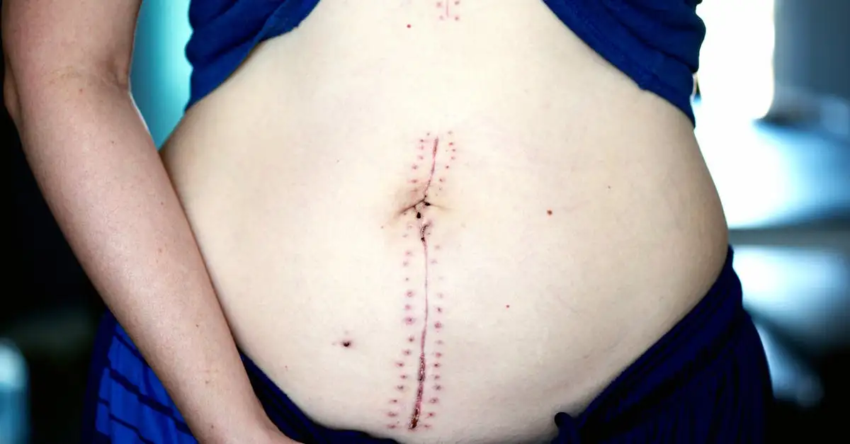 Voeding na operatie: Herstel en dieetadvies
